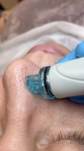 aec25fe56ac866e1f64339f2bfb06a07